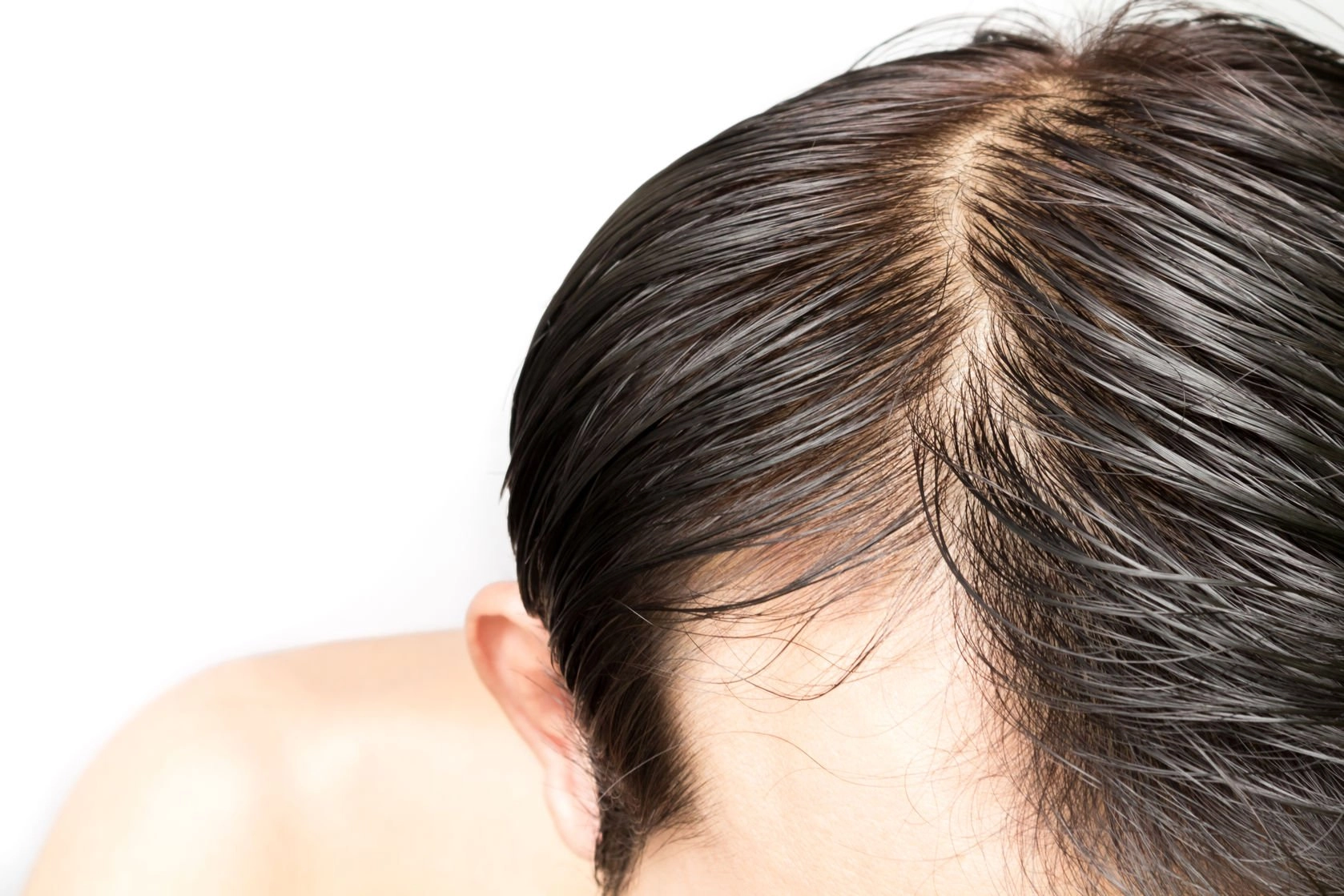 Essential Ingredients for Hair Loss Treatment in Singapore
